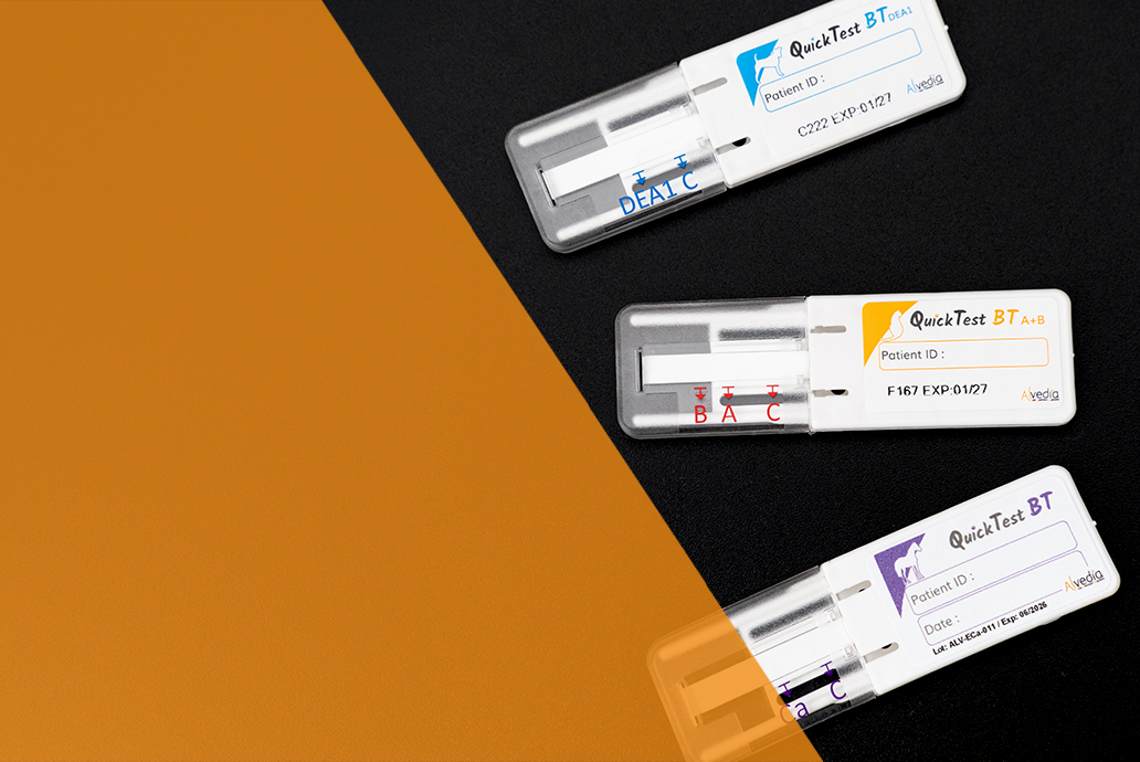 Chromatography test alvedia movie procedure