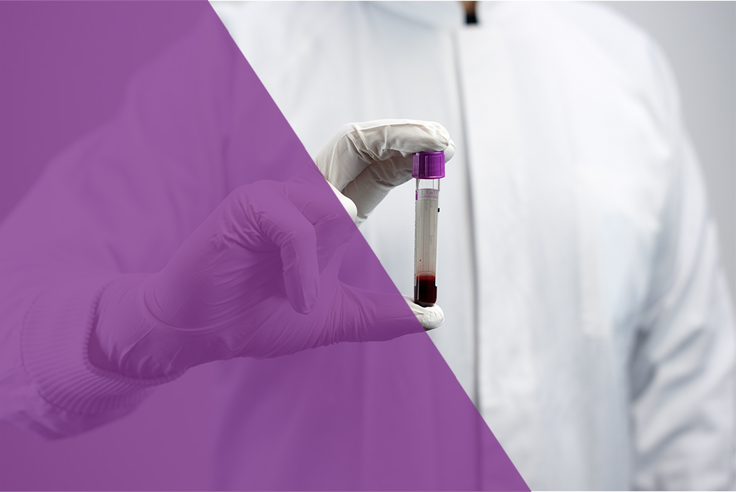 Material Preparation alvedia movie procedure